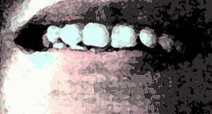 Gif animé bouche dents serrées